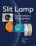 Slit Lamp: Examination and Photography
