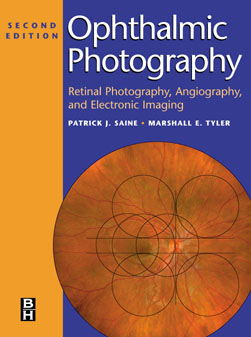 Ophthalmic Photography; Retinal Photography, Angiography and Electronic Imaging