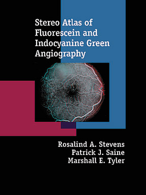 Stereo Atlas of Fluorescein and Indocyanine Green Angiogrphy